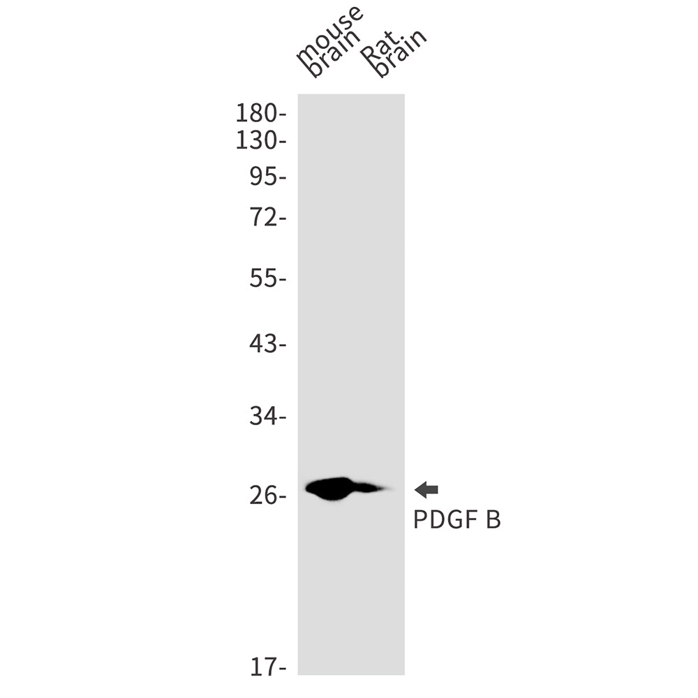 PDGF B Rabbit Monoclonal Antibody