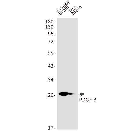PDGF B Rabbit Monoclonal Antibody