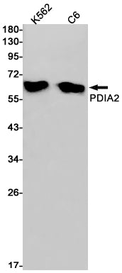 P4HB Rabbit Monoclonal Antibody