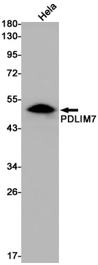 PDLIM7 Rabbit Monoclonal Antibody