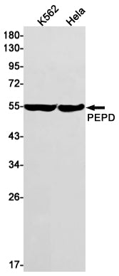 PEPD Rabbit Monoclonal Antibody