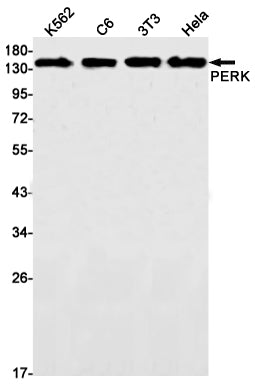 PERK Rabbit Monoclonal Antibody