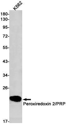 Peroxiredoxin 2 Rabbit Monoclonal Antibody
