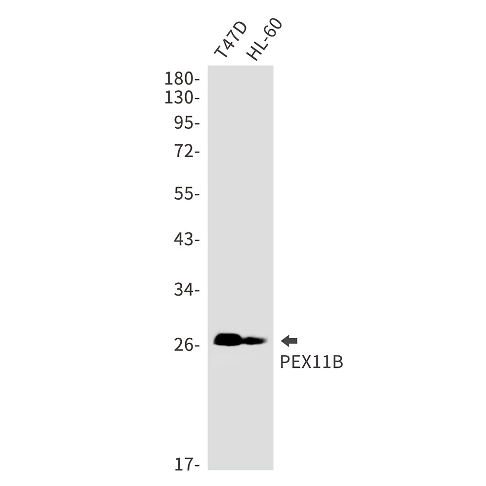 PEX11B Rabbit Monoclonal Antibody