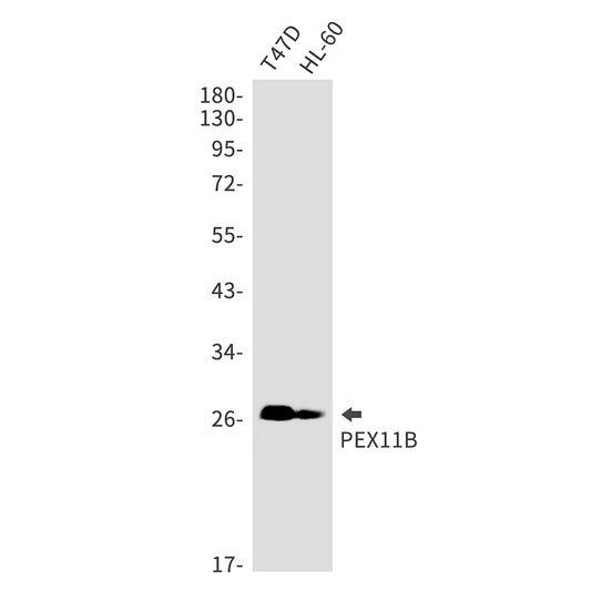 PEX11B Rabbit Monoclonal Antibody
