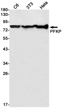 PFKP Rabbit Monoclonal Antibody