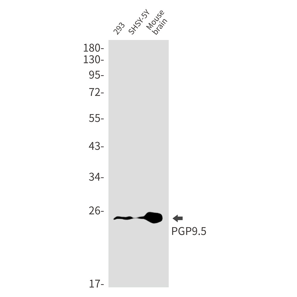 PGP9.5 Rabbit Monoclonal Antibody