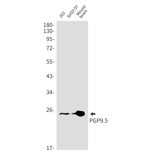 PGP9.5 Rabbit Monoclonal Antibody
