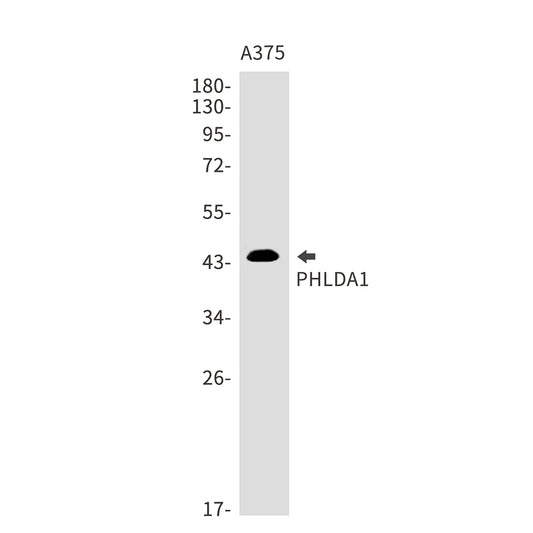 PHLDA1 Rabbit Monoclonal Antibody