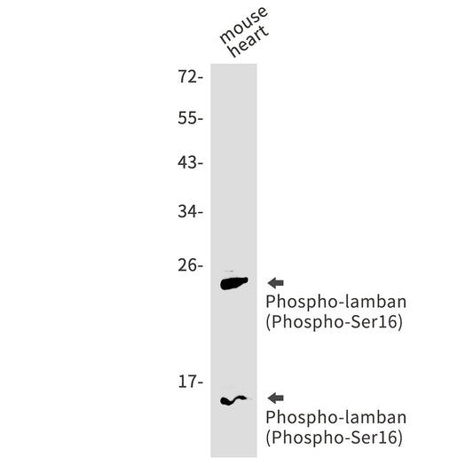 Phospho-Phospholamban (Ser16) Rabbit Monoclonal Antibody