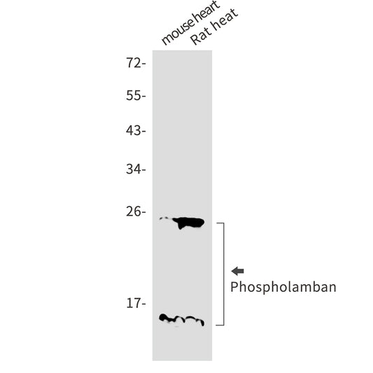Phospholamban Rabbit Monoclonal Antibody