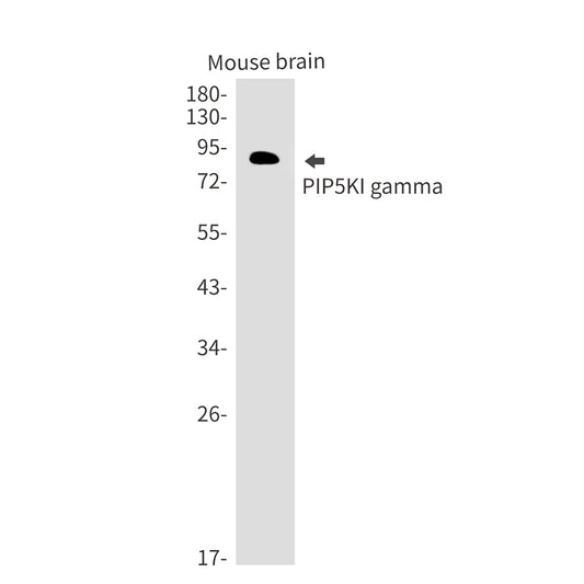 PIP5K1C Rabbit Monoclonal Antibody