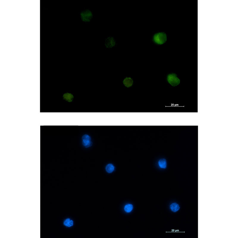 PKC beta 2 Rabbit Monoclonal Antibody