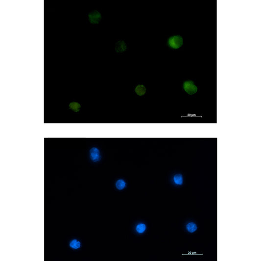 PKC beta 2 Rabbit Monoclonal Antibody