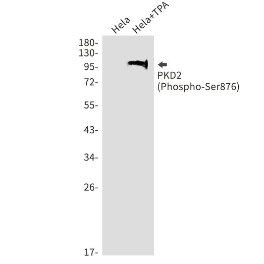 Phospho-PRKD2 (Ser876) Rabbit Monoclonal Antibody