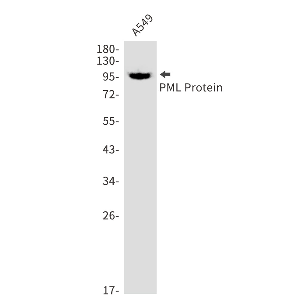 PML Protein Rabbit Monoclonal Antibody