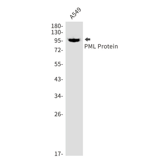 PML Protein Rabbit Monoclonal Antibody