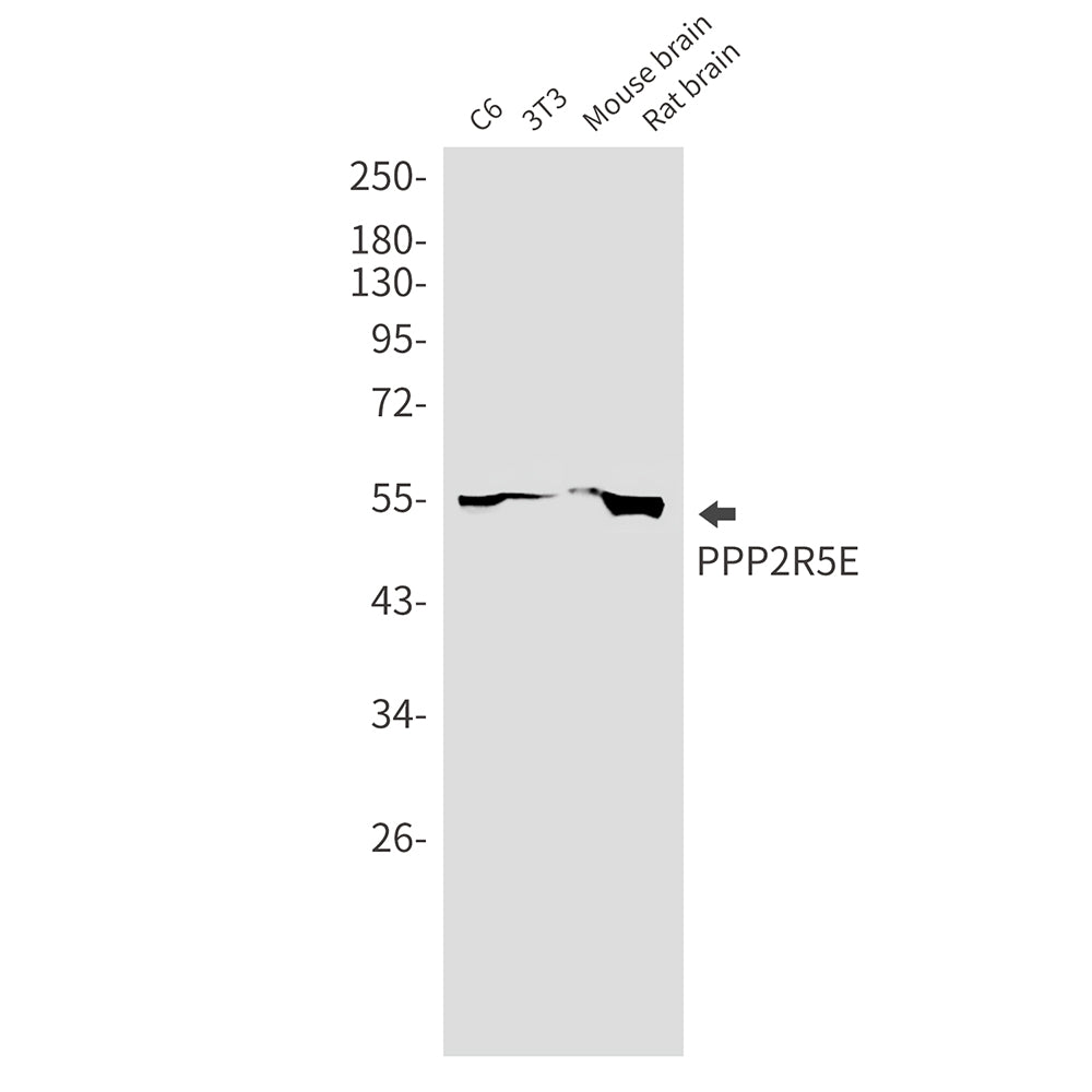 PPP2R5E Rabbit Monoclonal Antibody