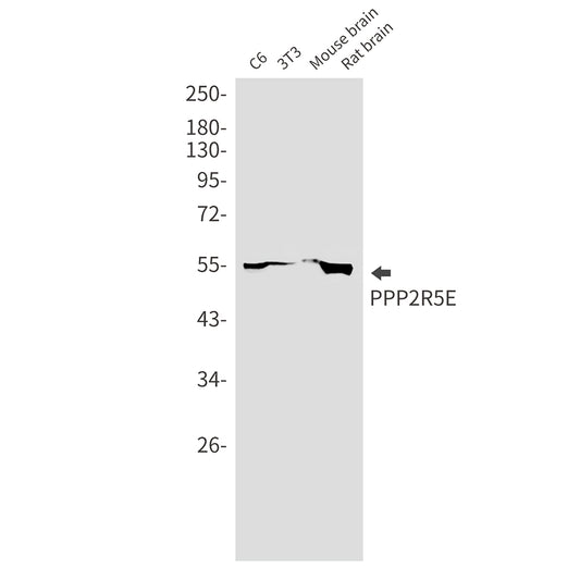 PPP2R5E Rabbit Monoclonal Antibody
