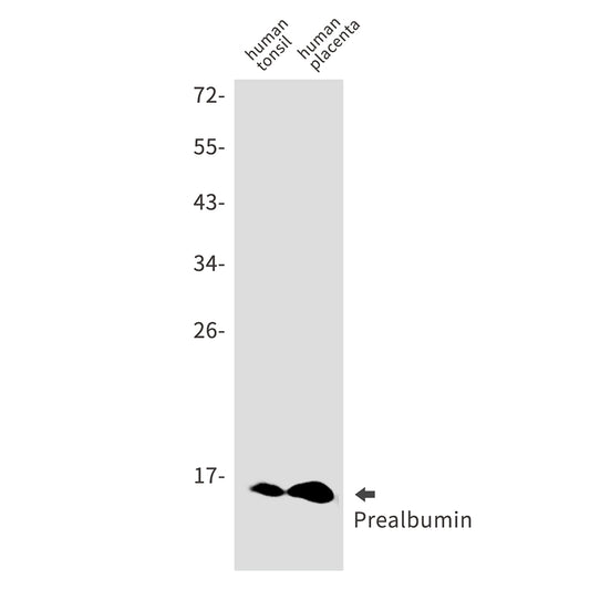 Prealbumin Rabbit Monoclonal Antibody