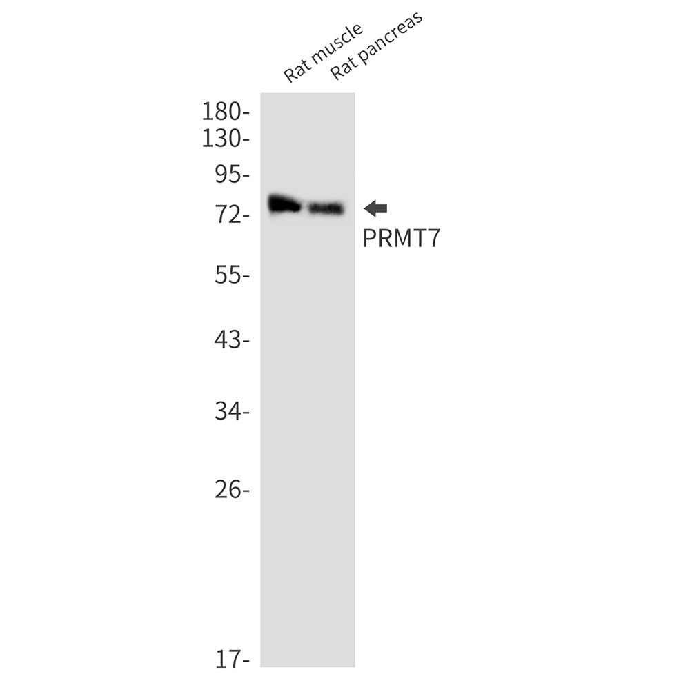 PRMT7 Rabbit Monoclonal Antibody