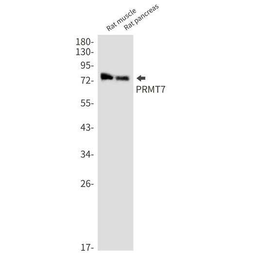 PRMT7 Rabbit Monoclonal Antibody