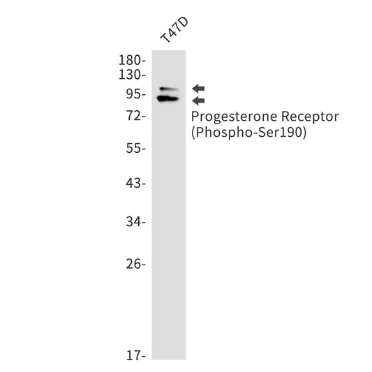 Phospho-Progesterone Receptor (Ser190) Rabbit Monoclonal Antibody