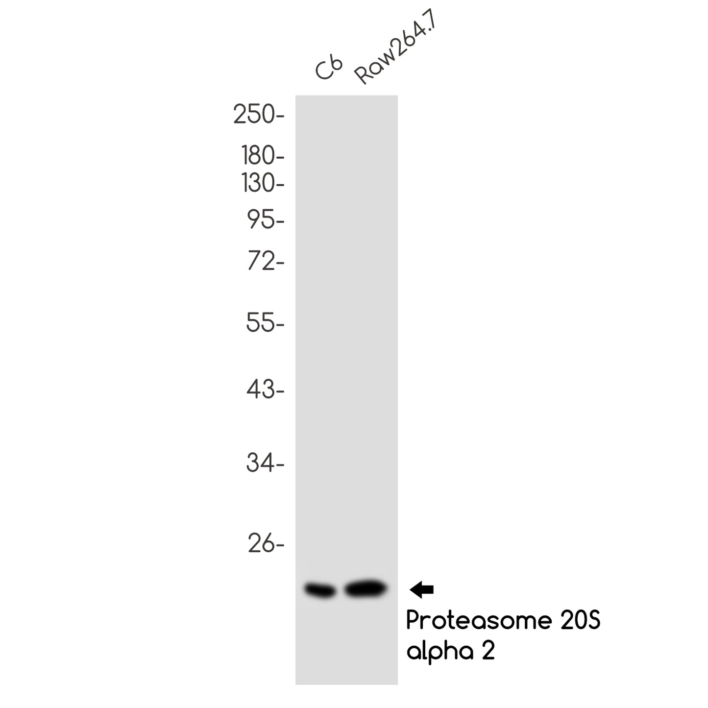 Proteasome beta 9 Rabbit Monoclonal Antibody