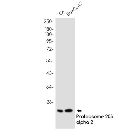 Proteasome beta 9 Rabbit Monoclonal Antibody