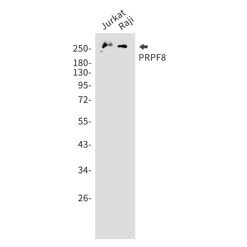 PRPF8 Rabbit Monoclonal Antibody