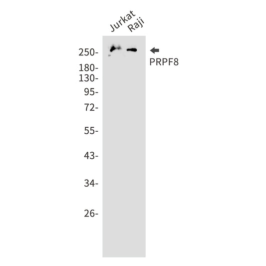 PRPF8 Rabbit Monoclonal Antibody