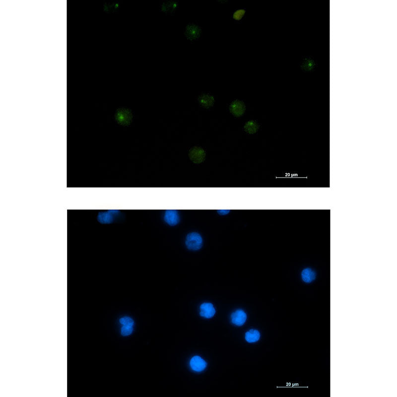 PSF1 Rabbit Monoclonal Antibody