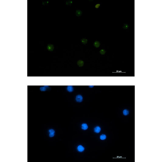 PSF1 Rabbit Monoclonal Antibody