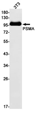 PSMA Rabbit Monoclonal Antibody
