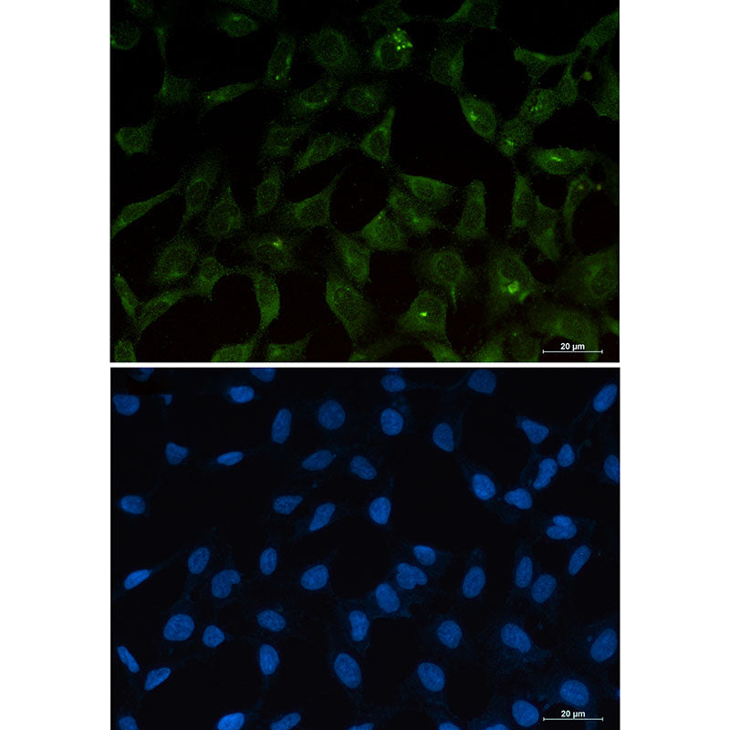 PUMA Rabbit Monoclonal Antibody