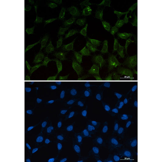 PUMA Rabbit Monoclonal Antibody