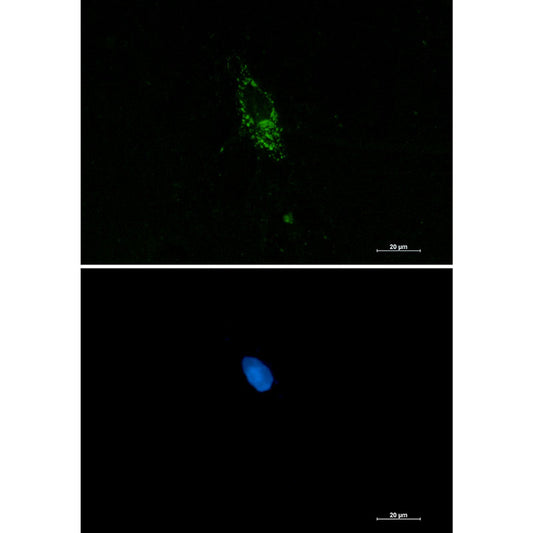 PUM1 Rabbit Monoclonal Antibody