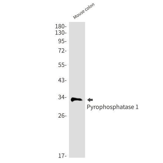 Pyrophosphatase 1 Rabbit Monoclonal Antibody
