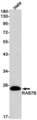 Rab7B Rabbit Monoclonal Antibody
