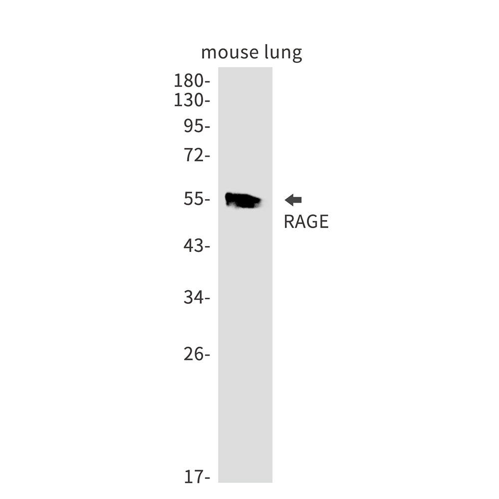 RAGE Rabbit Monoclonal Antibody
