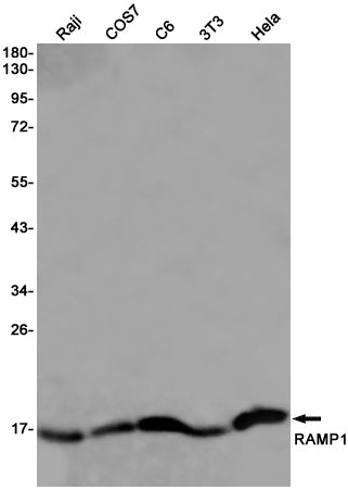 RAMP1 Rabbit Monoclonal Antibody
