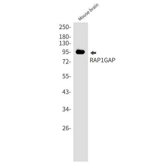 RAP1GAP Rabbit Monoclonal Antibody