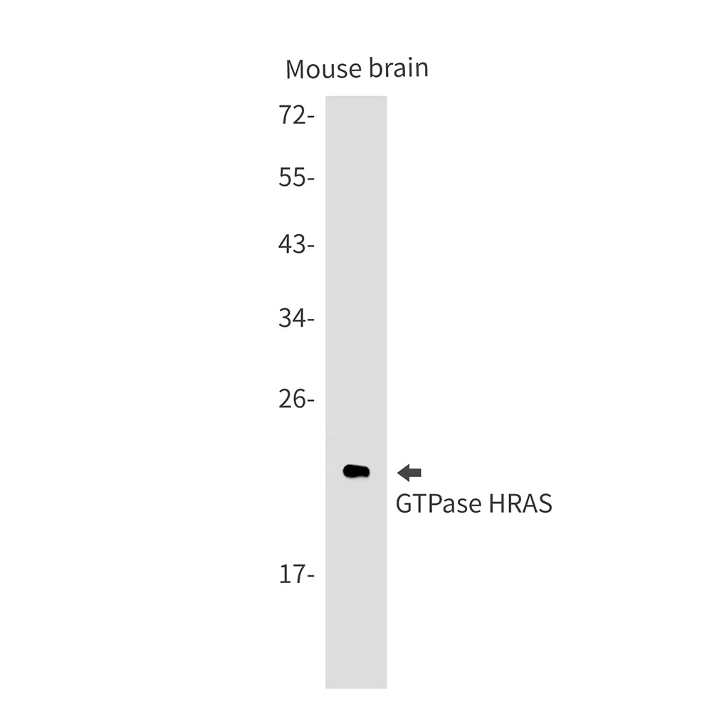 GTPase HRAS Rabbit Monoclonal Antibody