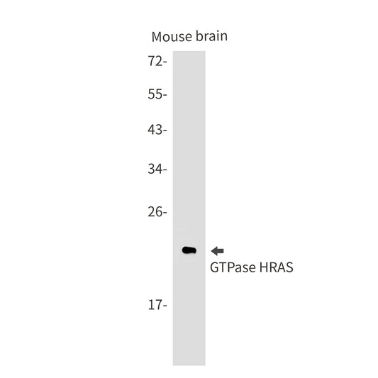 GTPase HRAS Rabbit Monoclonal Antibody