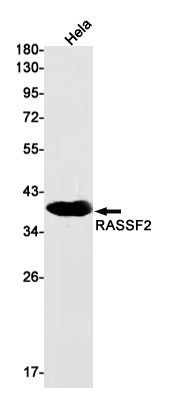 RASSF2 Rabbit Monoclonal Antibody