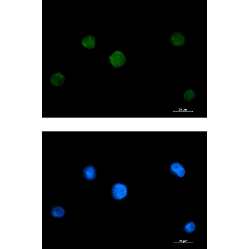 RAVER2 Rabbit Monoclonal Antibody