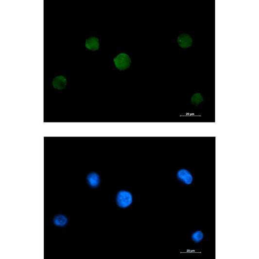 RAVER2 Rabbit Monoclonal Antibody