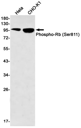 Phospho-Rb (Ser811) Rabbit Monoclonal Antibody