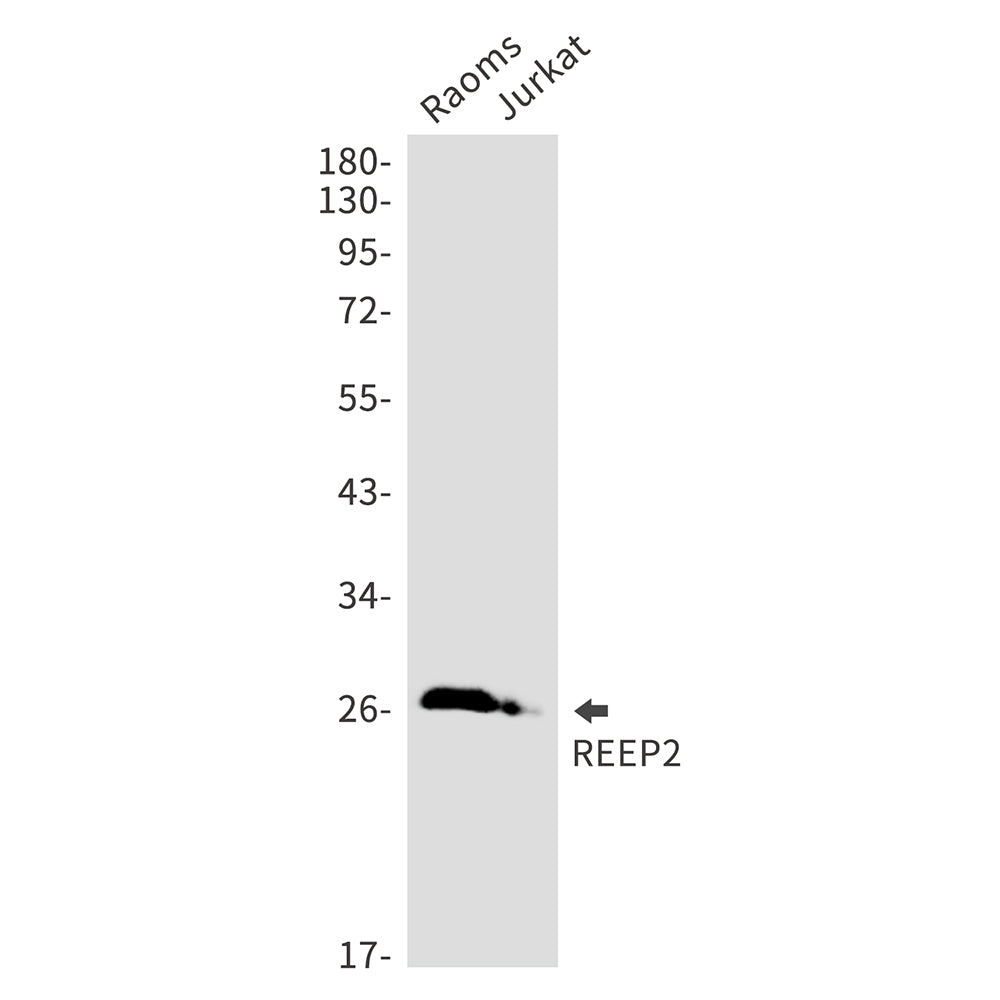 REEP2 Rabbit Monoclonal Antibody