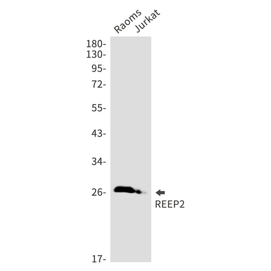 REEP2 Rabbit Monoclonal Antibody